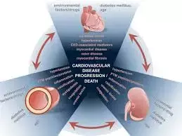 Iron Deficiency Linked to Kidney Failure, Mortality, and Heart Failure in CKD patients: Study