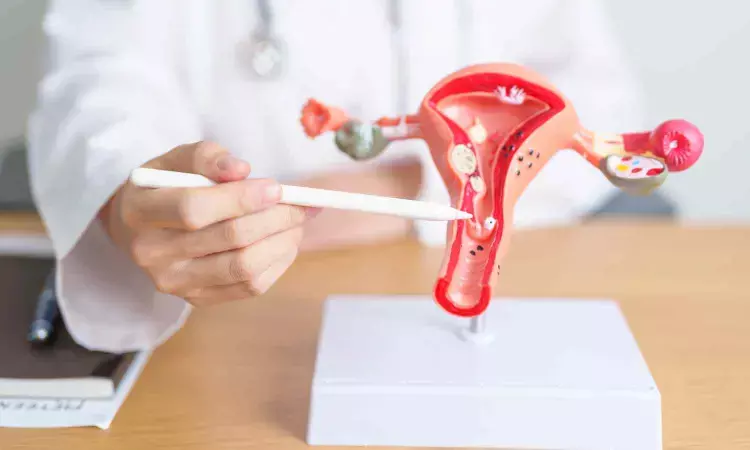 Vaginal dysbiosis increases risk of endometrial polyp recurrence after hysteroscopic polypectomy: Study