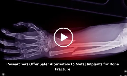 New Study Suggests Safer Option Over Metal Implants for Bone Fracture