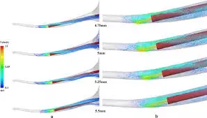 Can Working Length of ultrasonic tip impact Root Canal Dynamics?