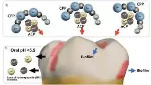 Both CPP-ACPF and sodium fluoride  have protective effect on Enamel, suggests study