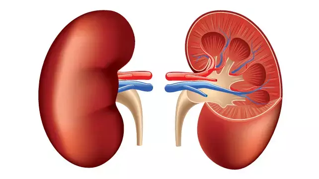 Metabolic Syndrome independently associated with increased susceptibility to renal cell carcinoma, finds study