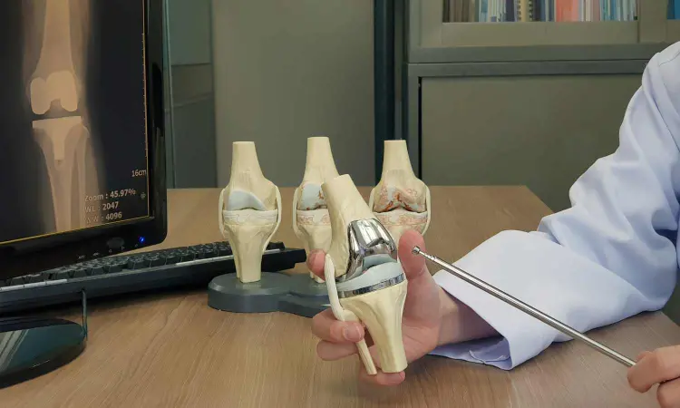 3D-printed knee implants improves quality and reliability,  suggests study