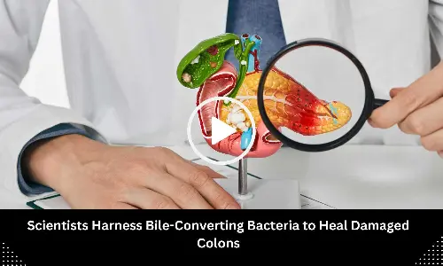 Scientists Harness Bile-Converting Bacteria to Heal Damaged Colons