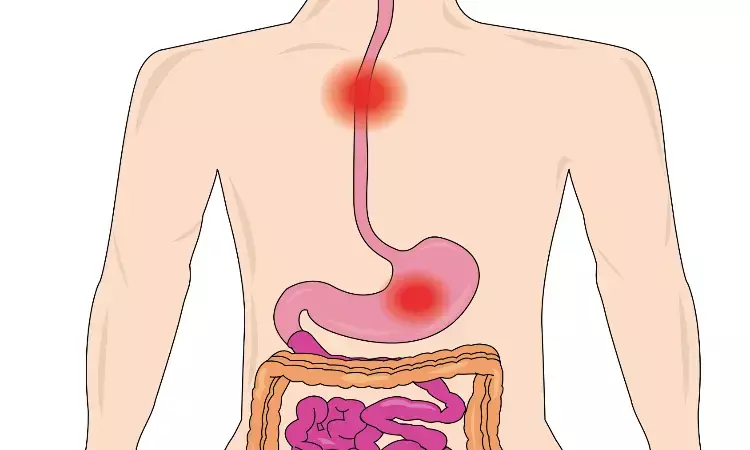 Tegoprazan Shows Superior Efficacy and Safety in Treating Esophageal Conditions in Phase 3 trial Tegoprazan Shows Superior Efficacy and Safety in Treating Esophageal Conditions in Phase 3 trial