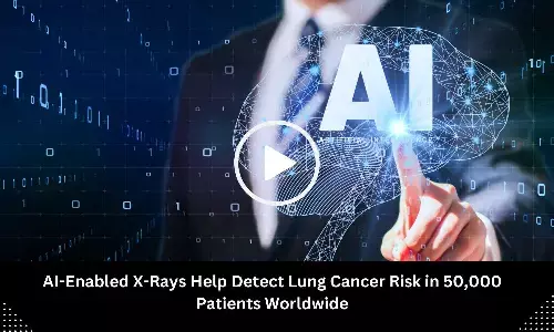 AI-Enabled X-Rays Help Detect Lung Cancer Risk in 50,000 Patients Worldwide: Study Shows