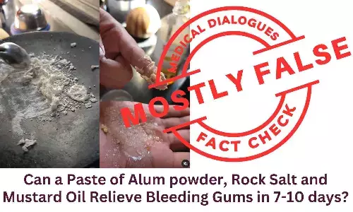 Fact Check: Can a Paste of Alum powder, Rock Salt and Mustard Oil Relieve Bleeding Gums in 7-10 days? Fact Check: Can a Paste of Alum powder, Rock Salt and Mustard Oil Relieve Bleeding Gums in 7-10 days?