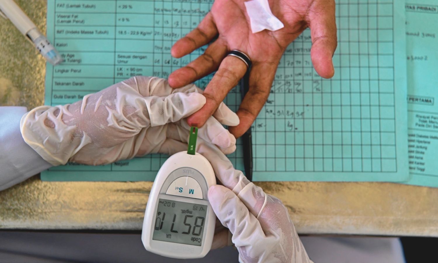 Hospital Hyperglycemia in Prediabetic Patients Converts into Clinical Diabetes within Just One Month: Study Finds