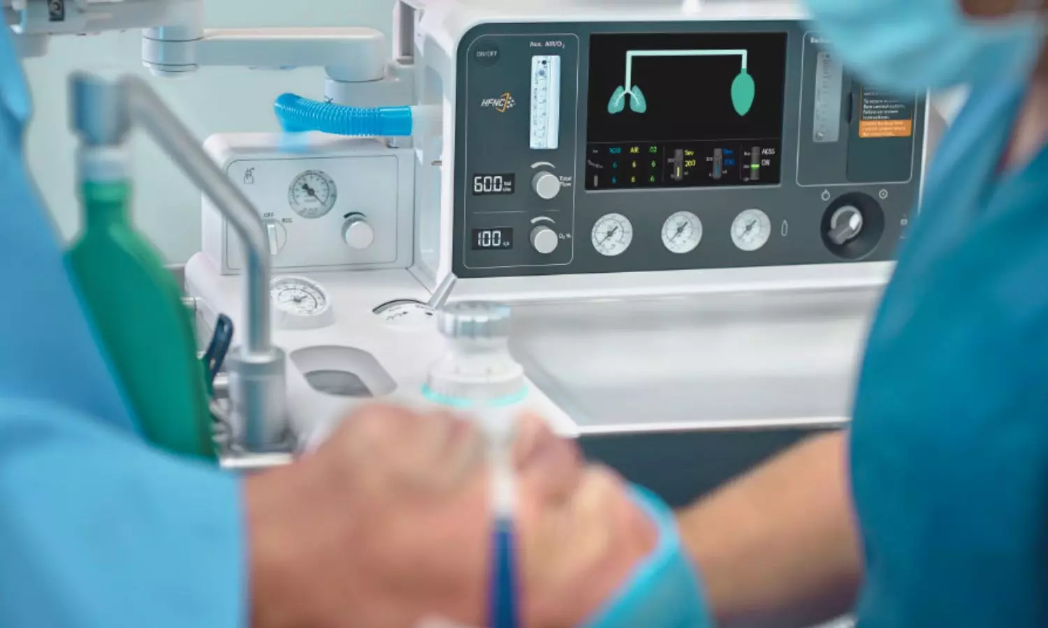 High Flow Nasal Cannula
