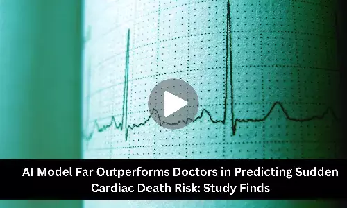AI Model Far Outperforms Doctors in Predicting Sudden Cardiac Death Risk: Study Finds
