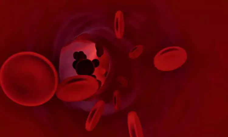 Aortic Stiffness May Predict Heart Risk and Death in Diabetes, Meta-Analysis Finds Aortic Stiffness May Predict Heart Risk and Death in Diabetes, Meta-Analysis Finds