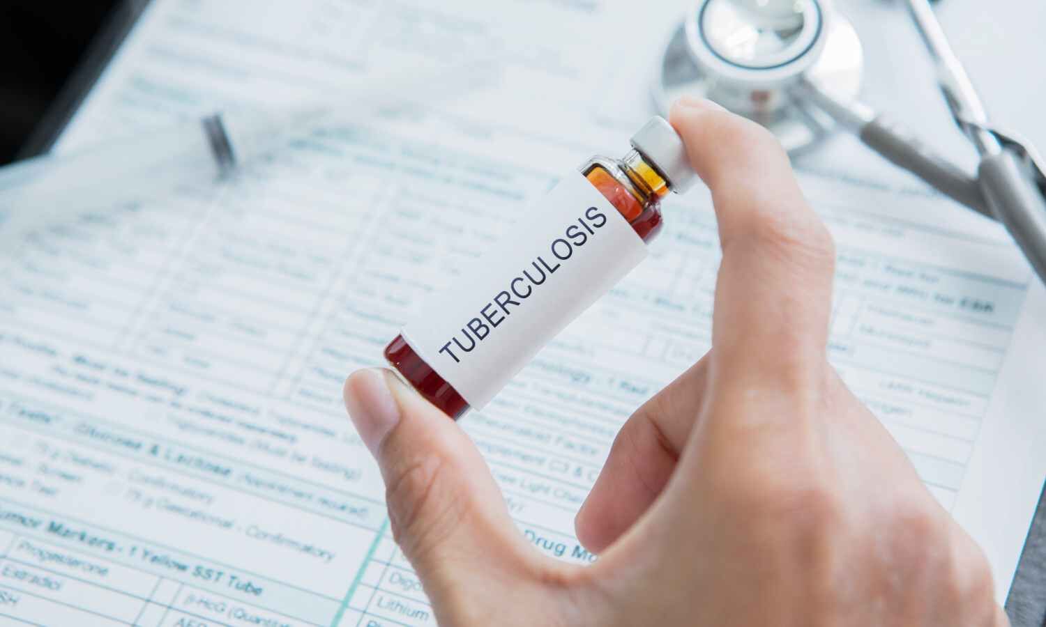 AI Tool Shows High Accuracy in TB Drug-Resistance Screening, ICMR-NIRT Study Finds