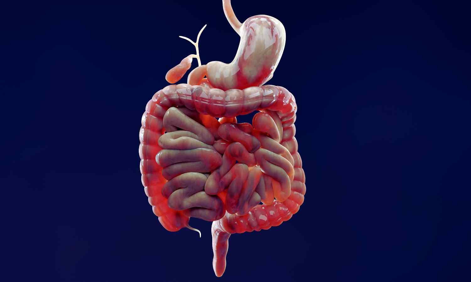 Stool Metabolites May Help Predict Crohn’s Disease Complications: Study