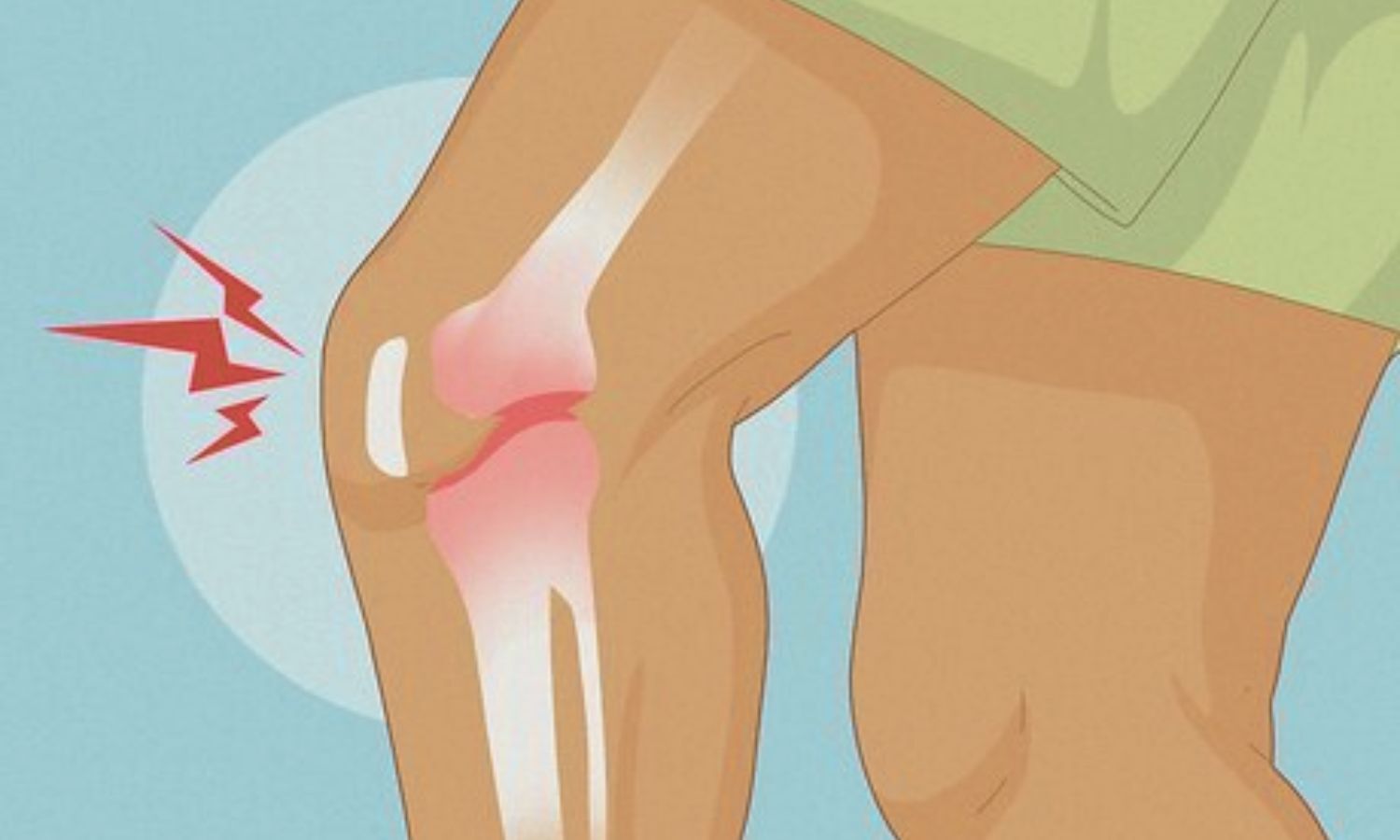 Cracking Sounds After Knee Injury? Research Shows Possible Early Osteoarthritis Changes