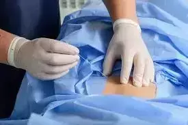 Transforaminal nerve root block effective, minimally invasive intervention for lumbar radiculopathy: study