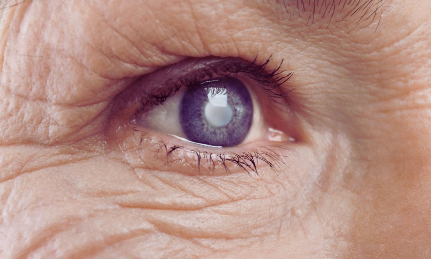 Goa Medical College seeks licence for corneal transplant facility