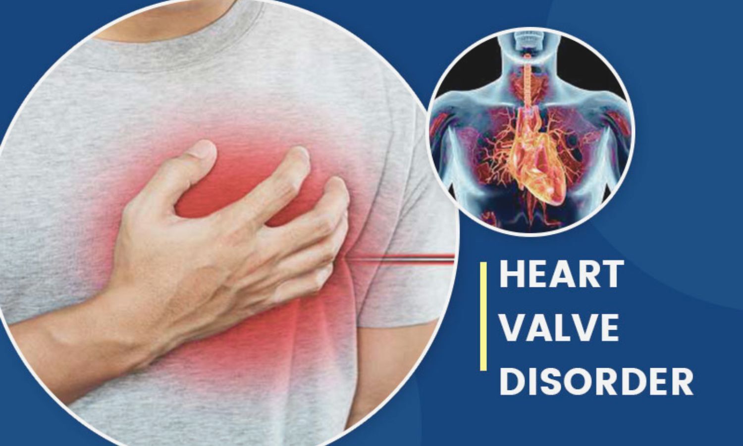 From AI to Transcatheter Therapies, Top Valvular Heart Disease Papers of 2025: Viewpoint Highlights