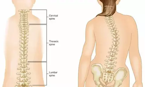 3D-printed drill guides offer superior pedicle screw placement accuracy in congenital scoliosis surgery: study 3D-printed drill guides offer superior pedicle screw placement accuracy in congenital scoliosis surgery: study