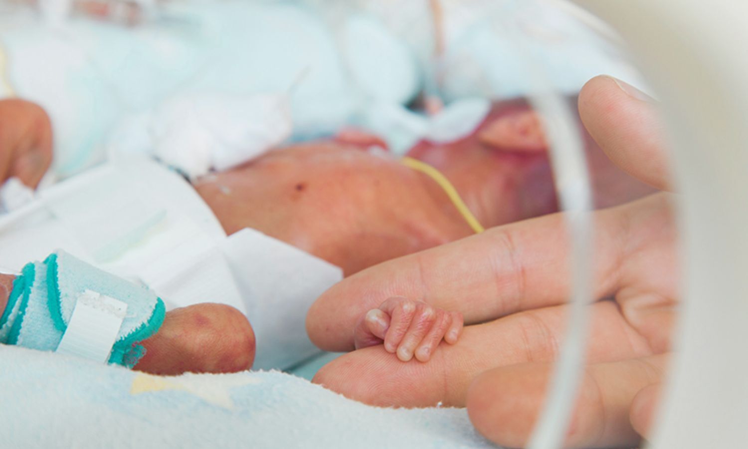 Multiple Maternal Chronic Conditions Increase Risk of Severe Neonatal Outcomes: Study