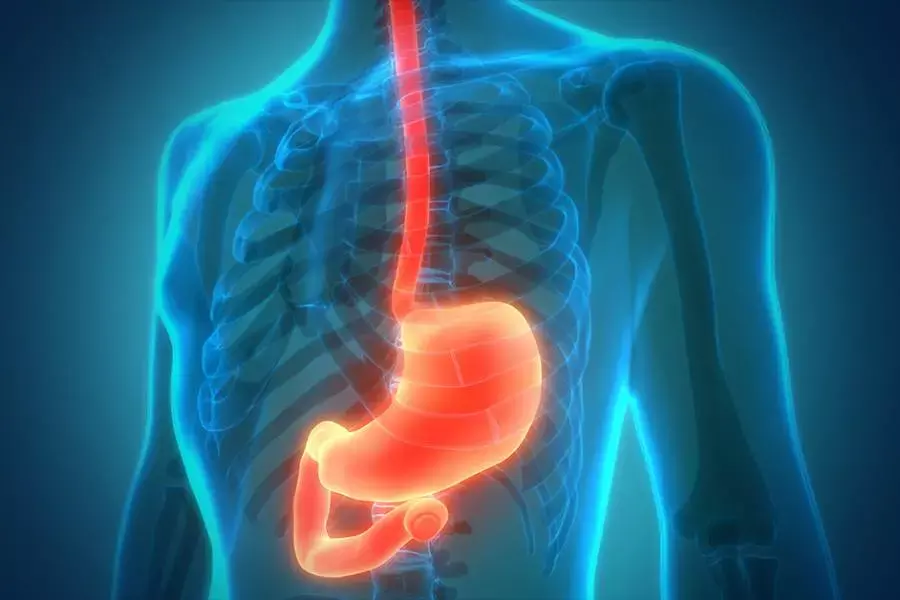 Esophagectomy has long-Term Survival Advantage Over Active Surveillance After neoadjuvant chemoradiation: JAMA