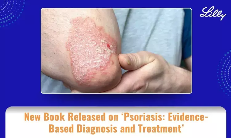 Book Released on Psoriasis: Evidence-Based Diagnosis and Treatment Offering Updated Comprehensive Clinical Insights for Clinicians Book Released on Psoriasis: Evidence-Based Diagnosis and Treatment Offering Updated Comprehensive Clinical Insights for Clinicians
