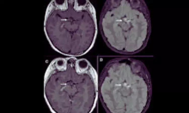 Beetroot Compound Betanin Promising as Safe, Natural Alternative to Gadolinium in MRI Scans, New Study Finds Beetroot Compound Betanin Promising as Safe, Natural Alternative to Gadolinium in MRI Scans, New Study Finds