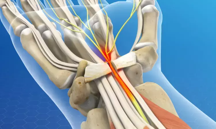 Wide-Awake Local Anesthesia Matches Nerve Block and Improves Comfort in Carpal Tunnel Release: Study Wide-Awake Local Anesthesia Matches Nerve Block and Improves Comfort in Carpal Tunnel Release: Study