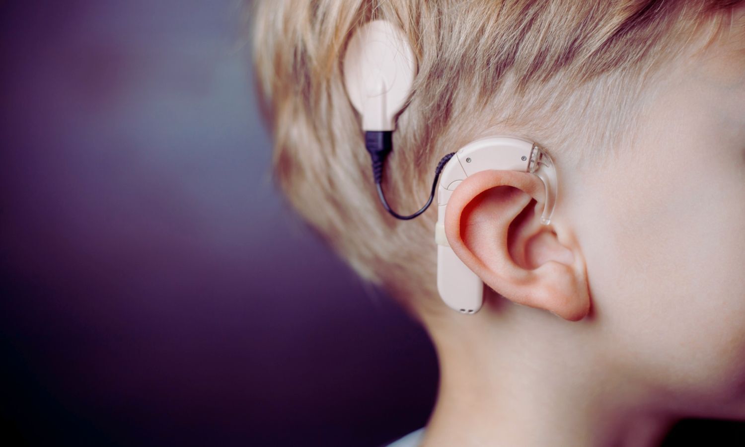 Musical Training Enhances Auditory Rehabilitation in Children with Cochlear Implants: Study