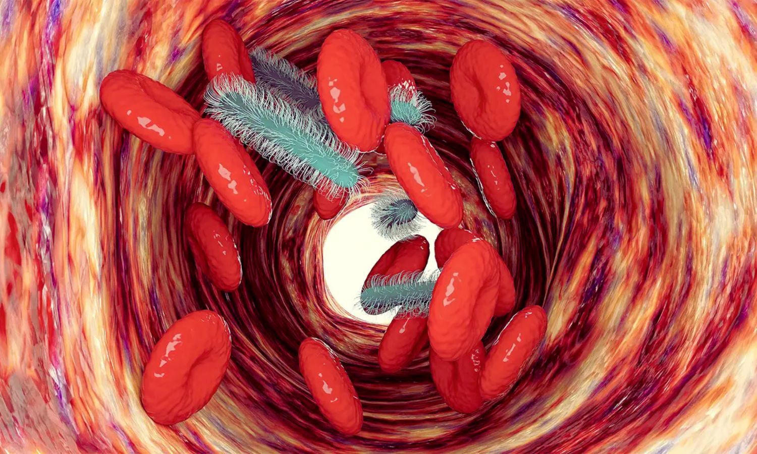 Precision Immunotherapy Improves Organ Dysfunction in Sepsis: Study