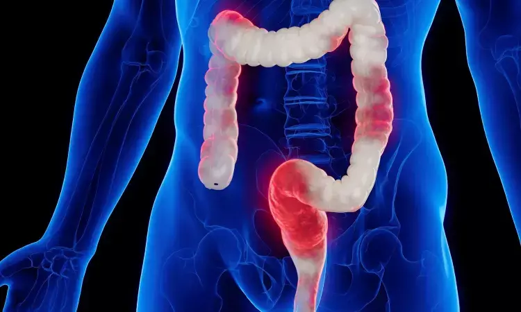 Low Blood Pressure Linked to Higher Ischemic Colitis Risk in Women: Study Low Blood Pressure Linked to Higher Ischemic Colitis Risk in Women: Study