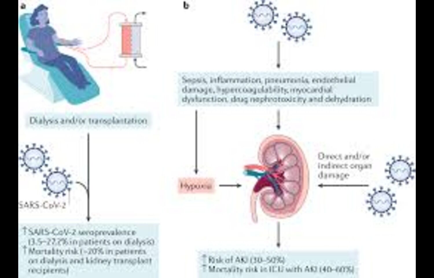 Chronic Kidney Disease Linked to Severe COVID-19 Outcomes: Study