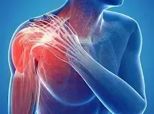 Hydrodilatation Effective for Adhesive Capsulitis Despite Rotator Cuff Tears: Study