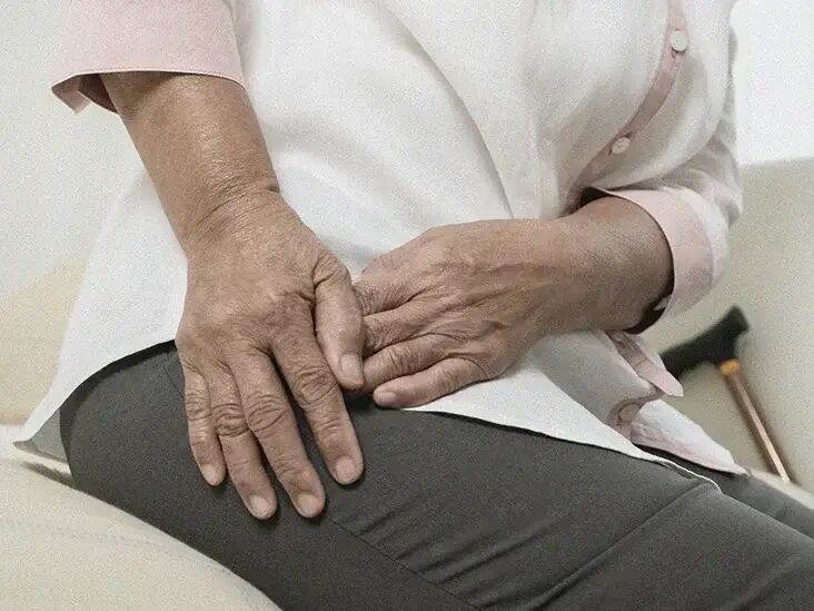 Markedly high prevalence of vitamin D deficiency in older patients presenting with hip fractures: study