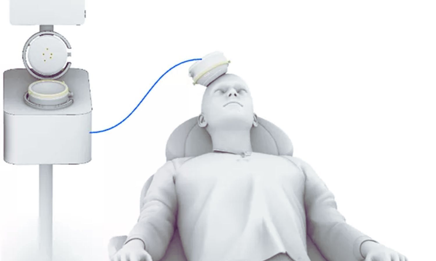 Indian Psychiatry Sees Growing Clinical Use of Transcranial Direct Current Stimulation: Study