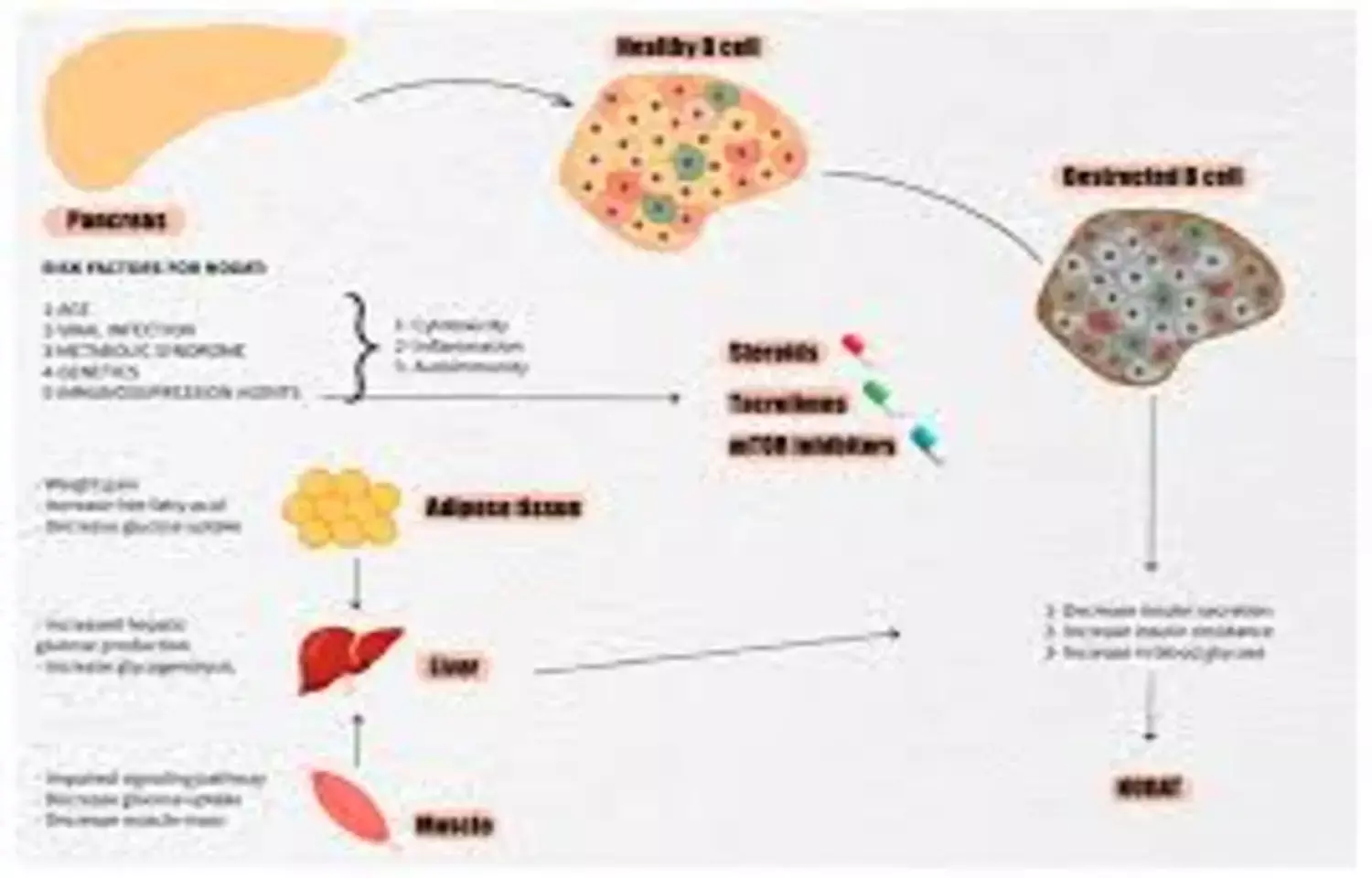Diabetes and Anuria Predict High Post-Void Residual After Kidney Transplantation: Study Diabetes and Anuria Predict High Post-Void Residual After Kidney Transplantation: Study