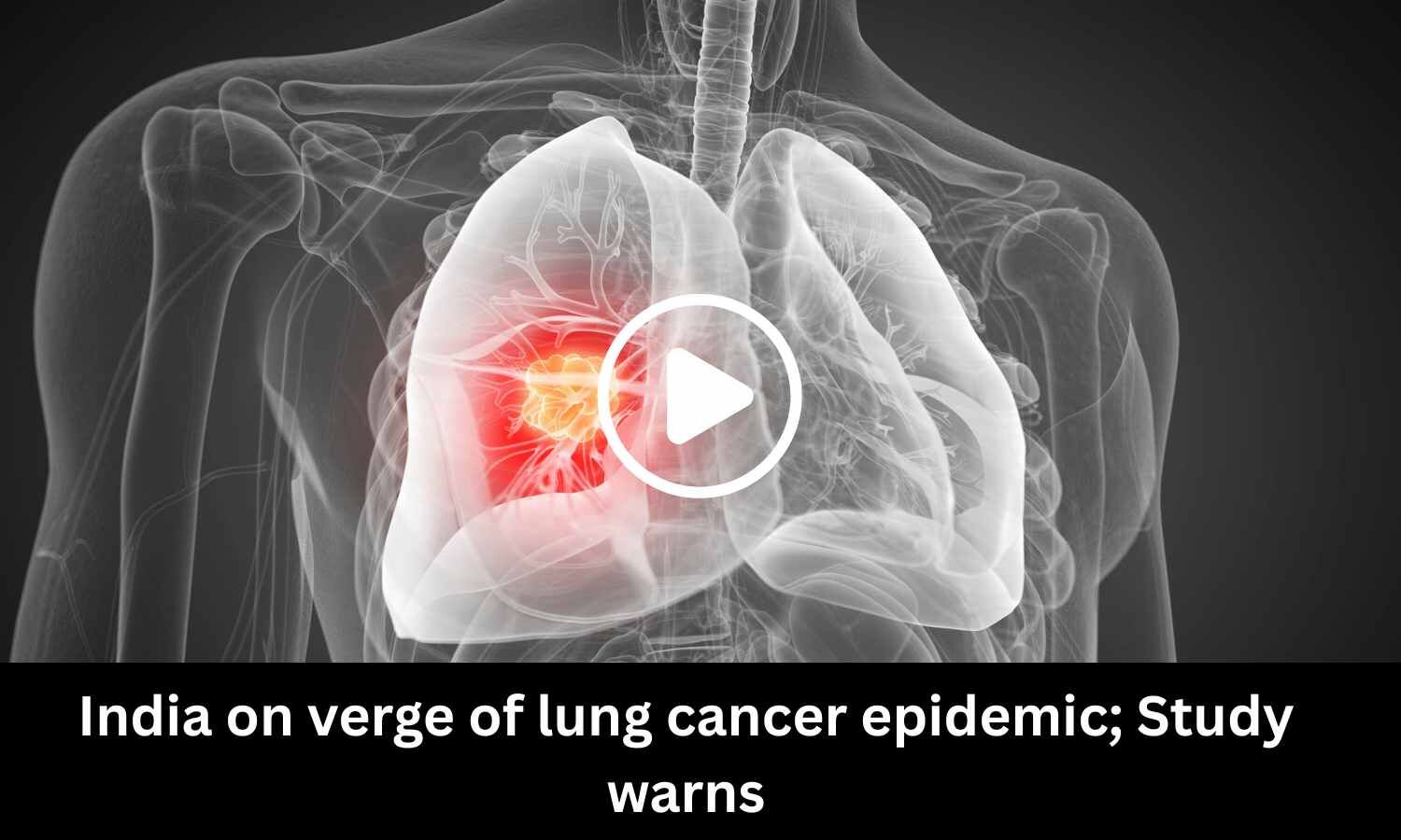 India on verge of lung cancer epidemic; Study warns