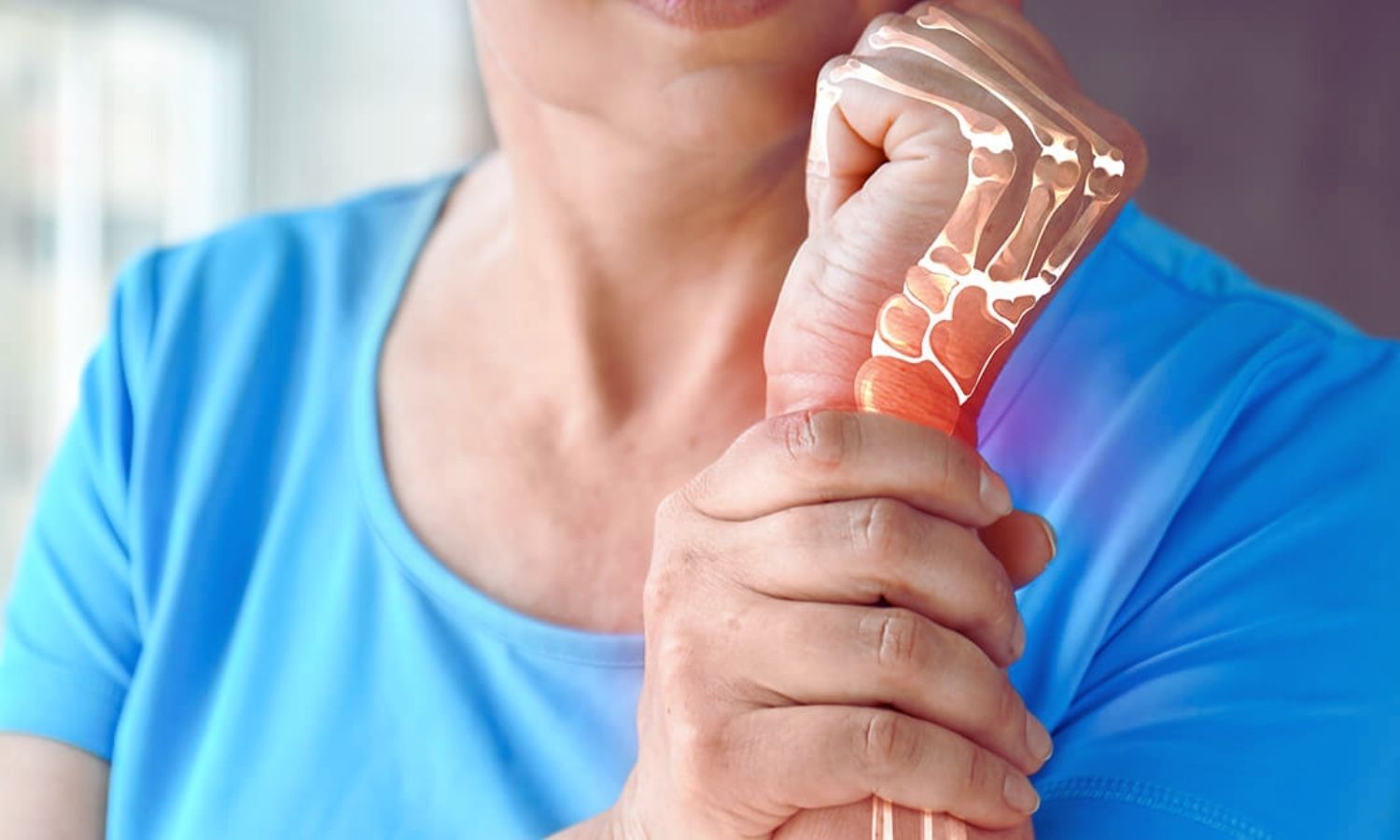 Romosozumab Boosts Bone Density in Postmenopausal Women Regardless of Age: Study Shows