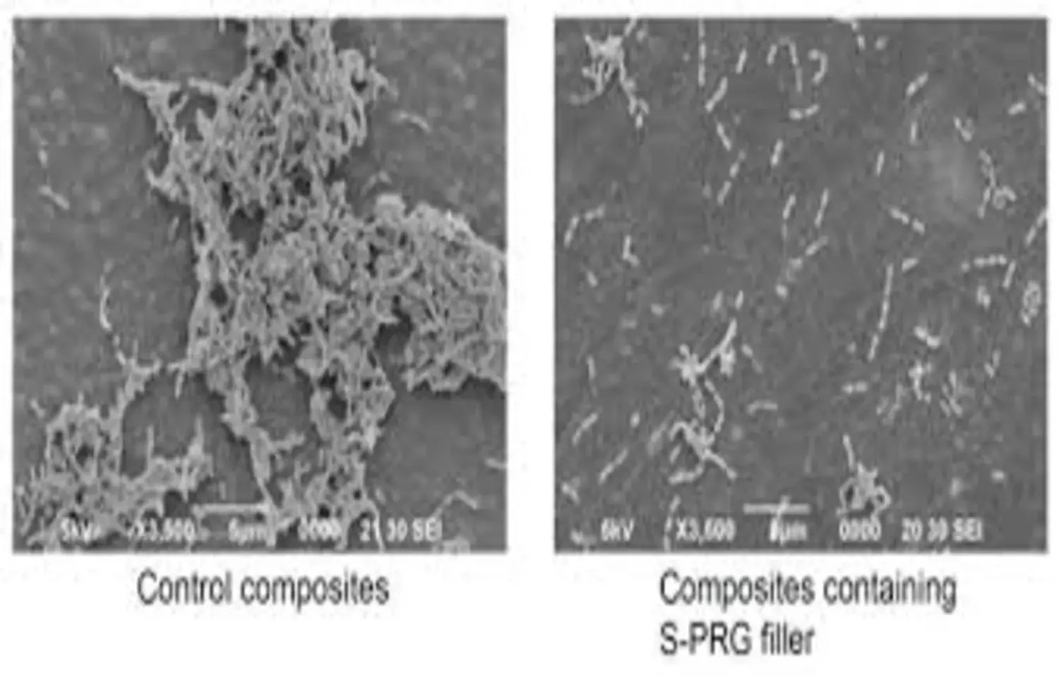 Resin Composites with S-PRG fillers may increase surrounding PH: Study