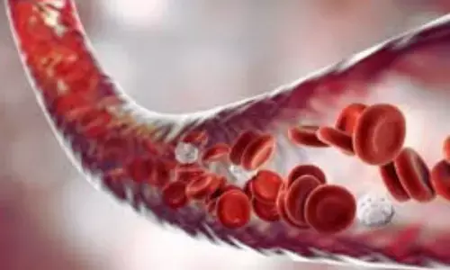 Iron Polymaltose Complex Bests Liposomal Iron for Improving Hematologic Response in Pediatric CKD With IDA: Study