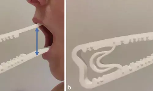 Early Trismus Therapy Shows Lasting Benefits After Facial Nerve Reconstruction: Study Early Trismus Therapy Shows Lasting Benefits After Facial Nerve Reconstruction: Study