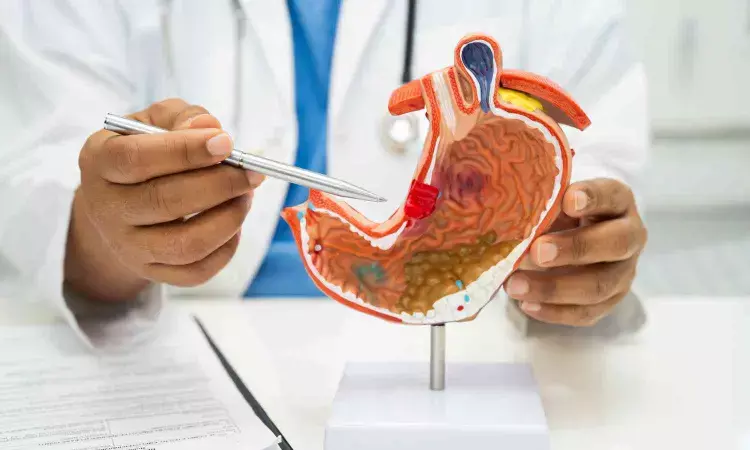 Long term use of anti-acid drugs may not increase stomach cancer risk Long term use of anti-acid drugs may not increase stomach cancer risk