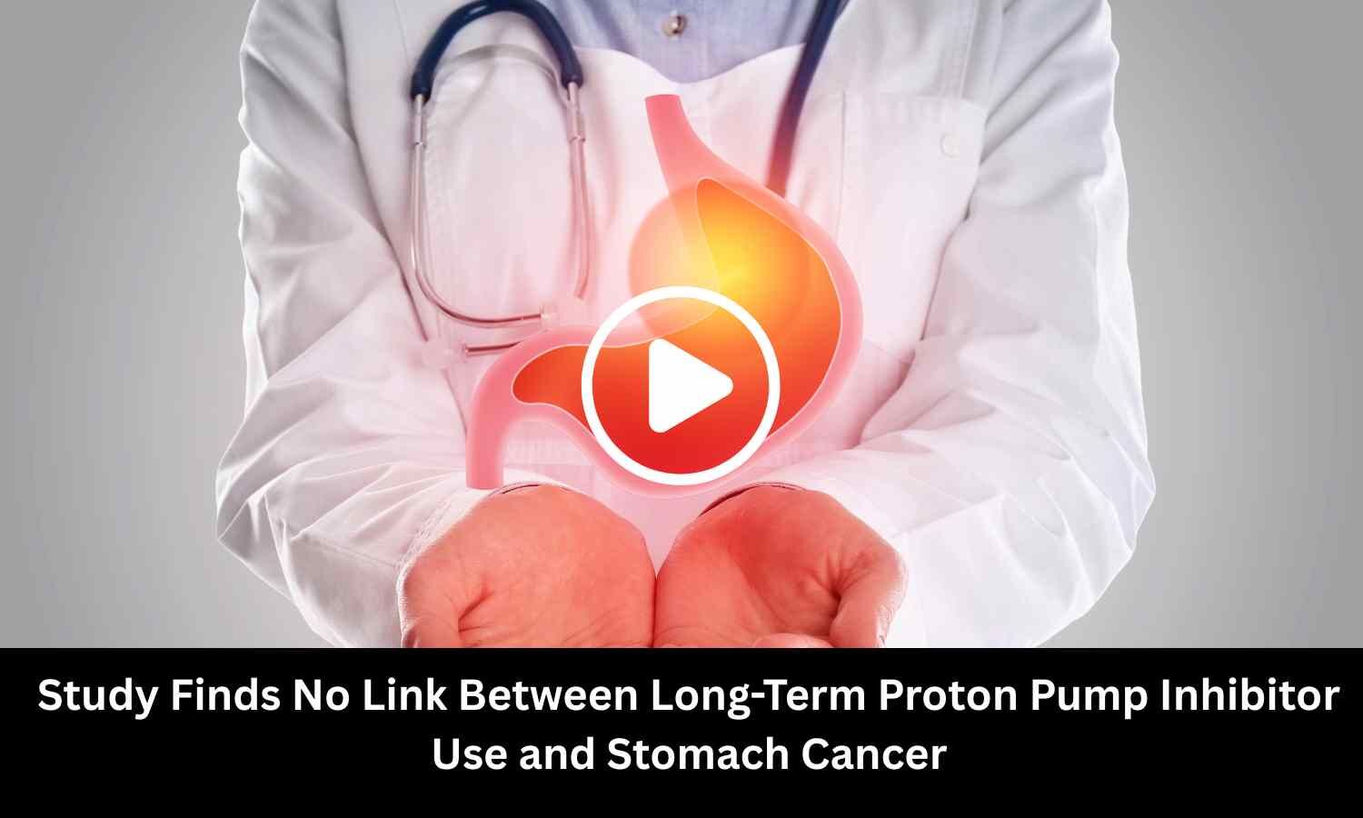 No Link Between Long-Term Proton Pump Inhibitor Use and Stomach Cancer: The BMJ Study Reveals