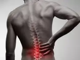 No long-term benefit of decompression of borderline lumbar spinal stenosis level adjacent to more stenotic index level: study