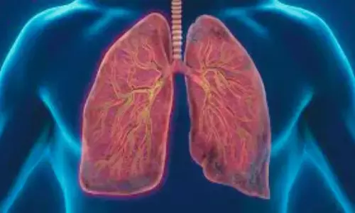 New Lung Mucin Score Improves Identification of Chronic Bronchitis: Study