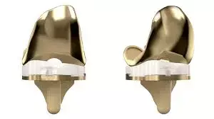 Kinematic Alignment-TKA using Medial Pivot implants appropriate surgical approach for valgus alignment knees: study