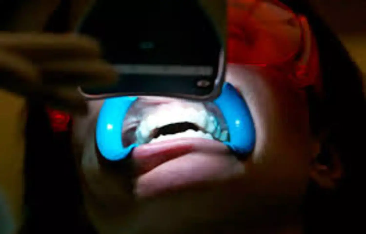 Vibration-Activated Whitening Powder Brightens Teeth While Protecting Enamel, suggests research