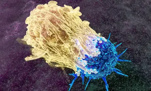 Cancer cases in India set to rise sharply by 2045, experts stress early detection