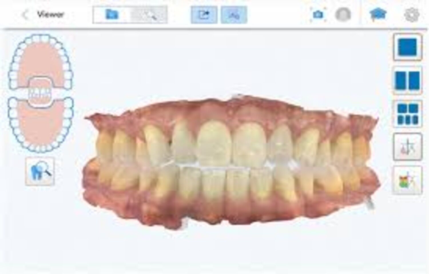 Digital jaw motion tracking may enhance Occlusal and TMJ Assessment, finds research