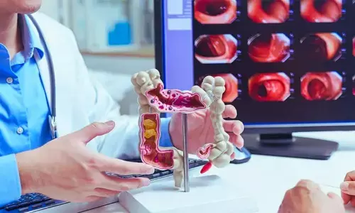 FIT Triage Accurately Flags High-Risk Symptomatic Patients for Colonoscopy: Study