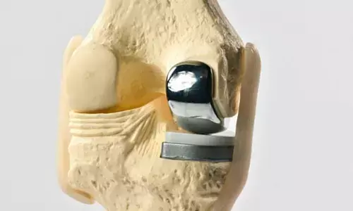 Need for developing Population-Specific Prosthetic Designs in unicompartmental knee arthroplasty for Indian Patients: Study